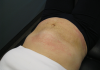 woman's abdomen